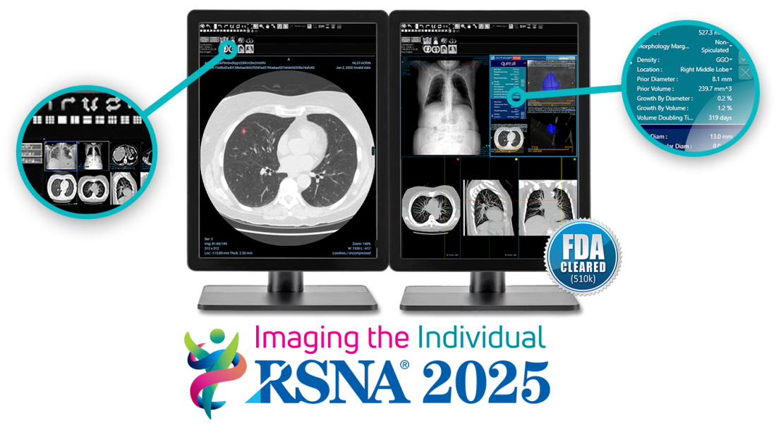 Fast_aiCockpit_rsna2025_A Fast_aiCockpit_rsna2025_A